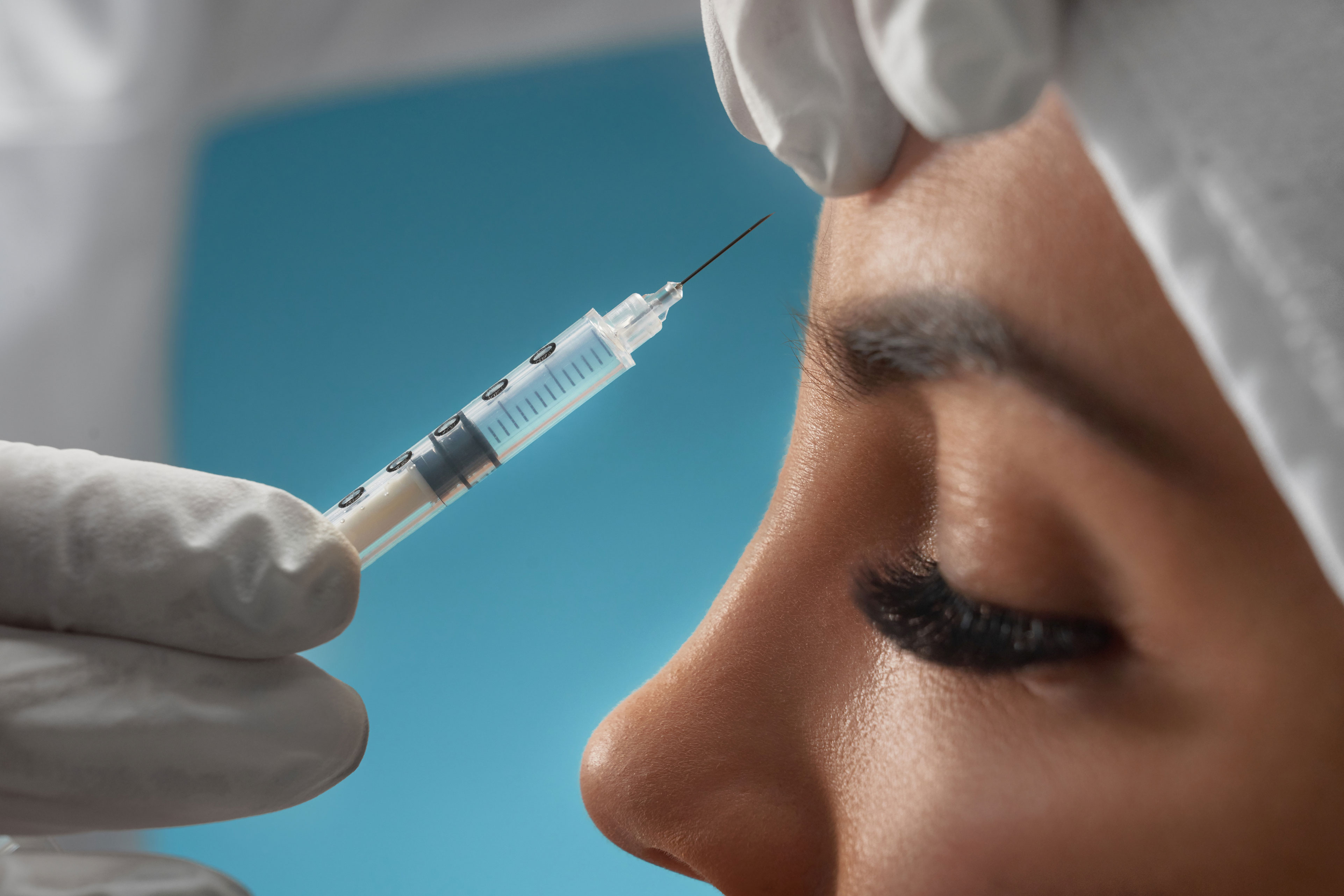 Tratamento de Botox pra Linhas de Expressão no Jaçanã